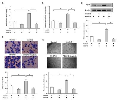 SHP-2-Induced Activation of c-Myc Is Involved in PDGF-B-Regulated Cell Proliferation and Angiogenesis in RMECs